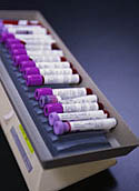 Fotografía de tubos de ensayo con sangre, con etiquetas