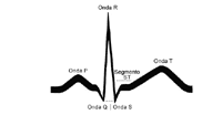Dibujo básico de los trazos del EKG (electrocardiograma)