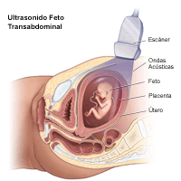 Ilustración de una ecografía fetal transabdominal