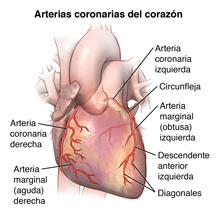 Muestra el exterior del corazón y las arterias coronarias